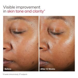dermatologist recommended sunscreen for sensitive skin